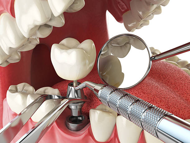 Best Emergency Care for Gum Disease in Wakeman, OH
